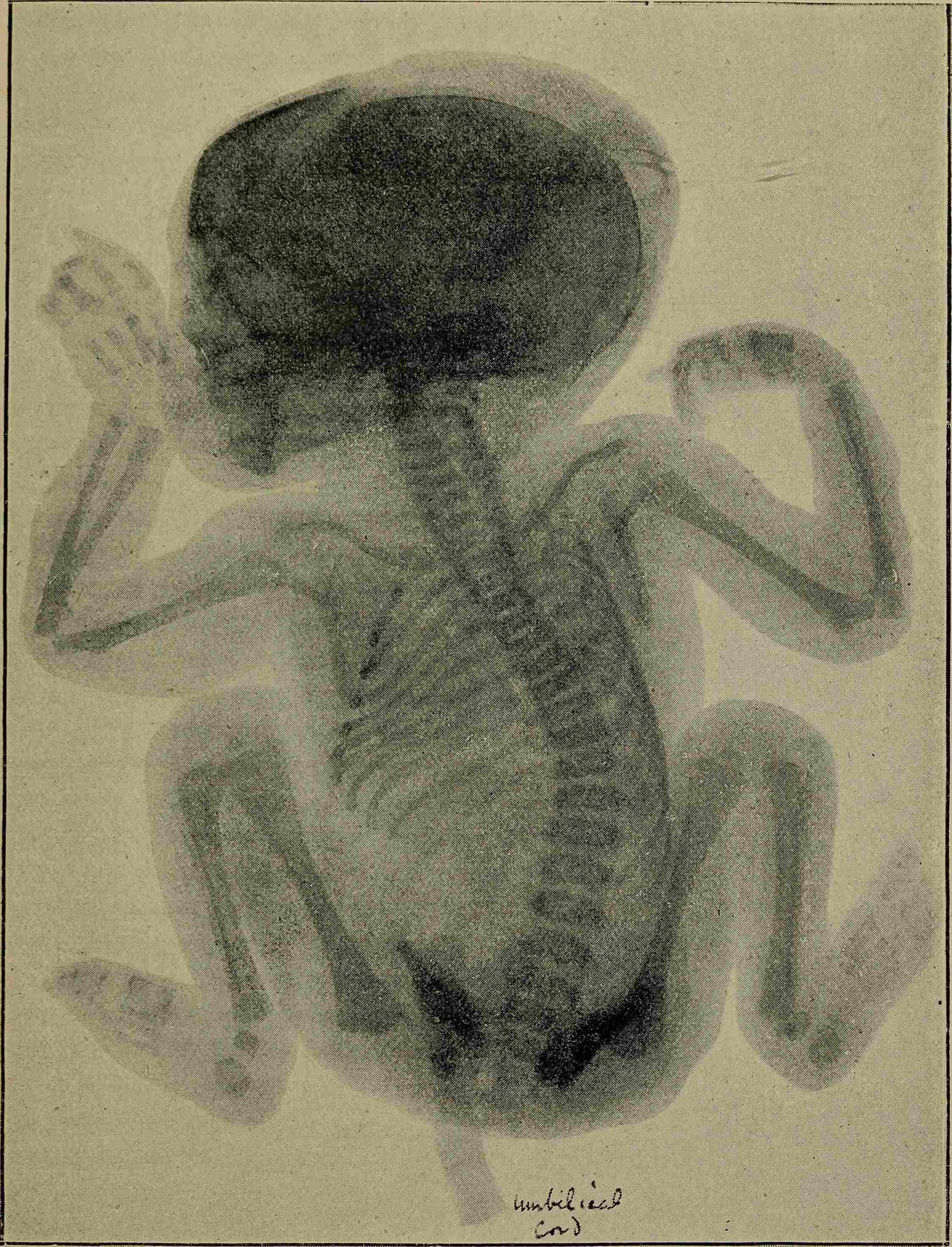 Images Wikimedia Commons/21 Walsh, David The_Röntgen_rays_in_medical_work_(1899)_(14570302349).jpg